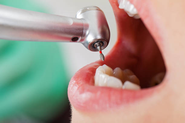 Best Root Canal Emergency Dentist  in French Island, WI